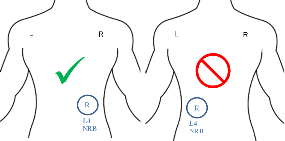 A close-up of a drawing Description automatically generated